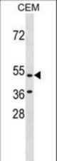 GPR109B Antibody western blot of CEM cell line lysates (35 ug/lane). The GPR109B antibody detected the GPR109B protein (arrow).