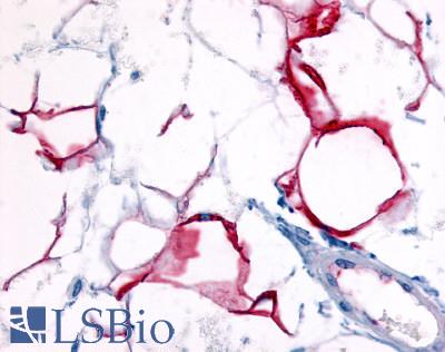 Anti-GPR109B / HM74 antibody LS-A183 IHC of human adipocytes. Immunohistochemistry of formalin-fixed, paraffin-embedded tissue after heat-induced antigen retrieval.