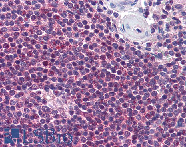 Anti-GPR109B / HM74 antibody IHC of human spleen. Immunohistochemistry of formalin-fixed, paraffin-embedded tissue after heat-induced antigen retrieval. Antibody LS-B1781 concentration 10 ug/ml.