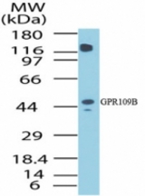 Western blot of human GPR109B in human liver lysate using antibody at 1 ug/ml.