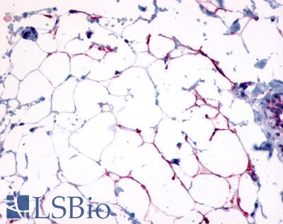 Anti-GPR109B / HM74 antibody IHC of human adipocytes. Immunohistochemistry of formalin-fixed, paraffin-embedded tissue after heat-induced antigen retrieval. Antibody LS-A179 dilution 3-4 ug/ml.