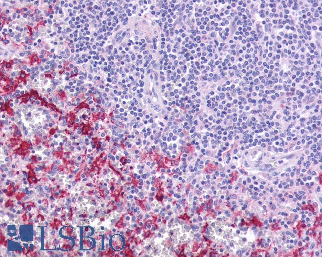 Anti-GPR109B / HM74 antibody IHC of human spleen. Immunohistochemistry of formalin-fixed, paraffin-embedded tissue after heat-induced antigen retrieval. Antibody LS-A179 dilution 3-4 ug/ml.
