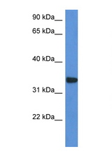 HCCS antibody LS-C135918 Western blot of HepG2 Cell lysate. Antibody concentration 1 ug/ml.