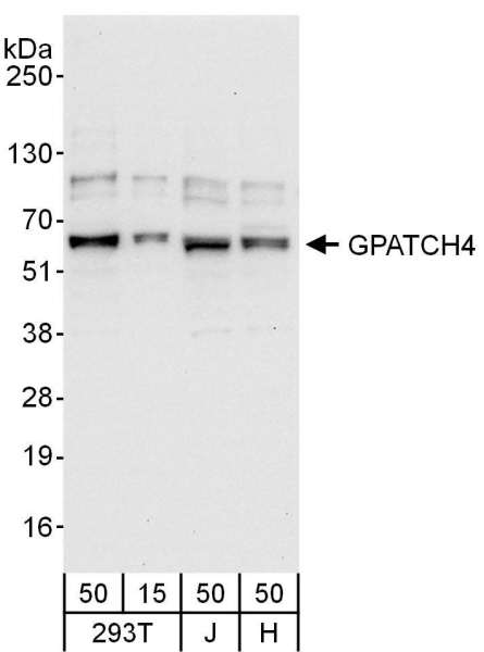 Detection of Human GPATCH4 by Western Blot. Samples: Whole cell lysate from 293T (15 and 50 ug), Jurkat (J; 50 ug) and HeLa (H; 50 ug) cells. Antibody: Affinity purified rabbit anti-GPATCH4 antibody used for WB at 0.04 ug/ml. Detection: Chemiluminescence with an exposure time of 10 seconds.