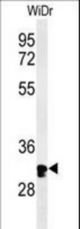 Western blot of HCCS Antibody in WiDr cell line lysates (35 ug/lane). HCCS (arrow) was detected using the purified antibody.