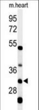 Western blot of HCCS Antibody in mouse heart tissue lysates (35 ug/lane). HCCS (arrow) was detected using the purified antibody.