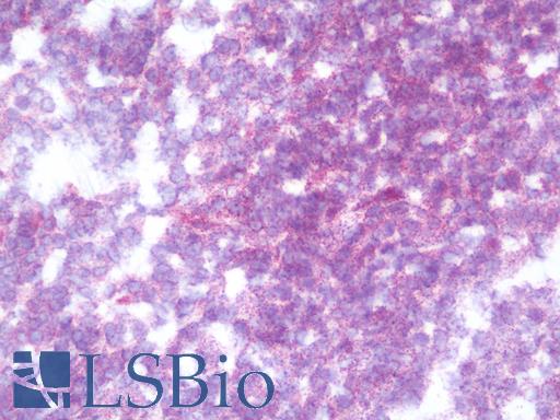 IHC with HCCS antibody on frozen human tonsil.