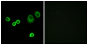 Immunofluorescence of MCF7 cells, using Cytochrome c-type Heme Lyase Antibody. The picture on the right is treated with the synthesized peptide.