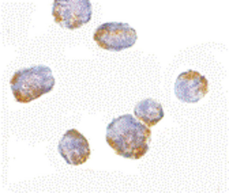 Immunocytochemistry of VPS53 in 293 cells with VPS53 antibody at 5 ug/ml.