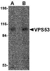 Western blot of VPS53 in 293 cell lysate with VPS53 antibody at (A) 0.5 and (B) 1 ug/ml.