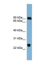 VPS53 antibody LS-C108094 Western blot of Fetal Muscle lysate.