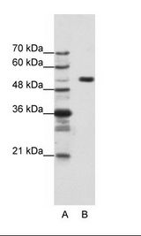 A: Marker, B: HepG2 Cell Lysate