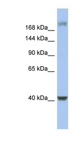 HCFC1 / HCF-1 antibody LS-C110294 Western blot of Fetal Stomach lysate.