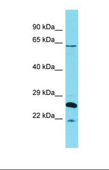 Western blot of Human Uterus Tumor. HCFC1 antibody dilution 1.0 ug/ml.