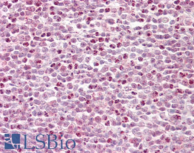 Anti-HCFC1 / HCF-1 antibody IHC of human tonsil. Immunohistochemistry of formalin-fixed, paraffin-embedded tissue after heat-induced antigen retrieval. Antibody LS-B7675 concentration 10 ug/ml.
