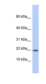 HCFC1R1 antibody LS-C111821 Western blot of Fetal Spleen lysate.