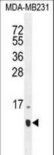 HCFC1R1 Antibody western blot of MDA-MB231 cell line lysates (35 ug/lane). The HCFC1R1 antibody detected the HCFC1R1 protein (arrow).