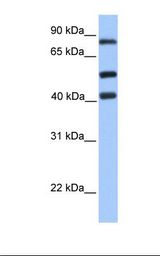 Jurkat cell lysate. Antibody concentration: 1.0 ug/ml. Gel concentration: 12%.
