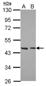Sample (30 ug of whole cell lysate) A: NT2D1 B: IMR32 10% SDS PAGE HCFC2 antibody diluted at 1:500