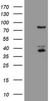 HEK293T cells were transfected with the pCMV6-ENTRY control (Left lane) or pCMV6-ENTRY HCFC2 (Right lane) cDNA for 48 hrs and lysed. Equivalent amounts of cell lysates (5 ug per lane) were separated by SDS-PAGE and immunoblotted with anti-HCFC2.