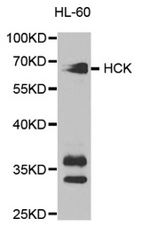 Western blot analysis of extracts of HL-60 cell lines, using HCK antibody.