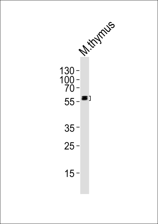 Western blot of lysate from mouse thymus tissue lysate with Mouse Hck Antibody. Antibody was diluted at 1:1000. A goat anti-rabbit IgG H&L (HRP) at 1:5000 dilution was used as the secondary antibody. Lysate at 35 ug.