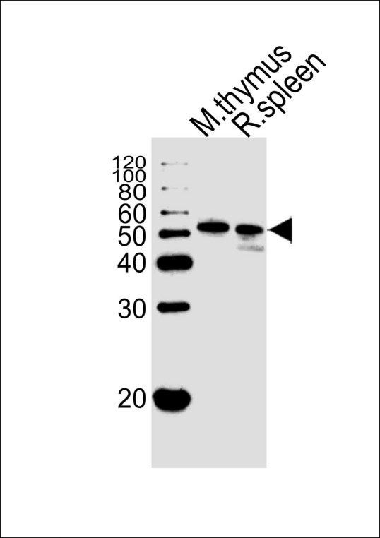 Western blot of lysate from mouse thymus and rat spleen tissue lysate (from left to right) with Mouse Hck Antibody. Antibody was diluted at 1:1000. A goat anti-rabbit IgG H&L (HRP) at 1:5000 dilution was used as the secondary antibody. Lysate at 35 ug.