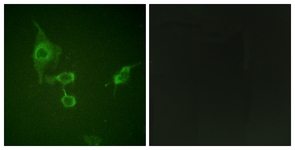 Immunofluorescence of HepG2 cells, using HCK (Ab-410) Antibody. The picture on the right is treated with the synthesized peptide.