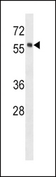 HCK Antibody (E8) western blot of human placenta tissue lysates (35 ug/lane). The HCK antibody detected the HCK protein (arrow).