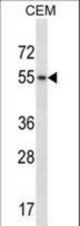 Mouse Hck Antibody western blot of CEM cell line lysates (35 ug/lane). The Hck antibody detected the Hck protein (arrow).