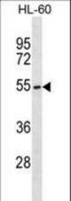MGAT3 Antibody western blot of HL-60 cell line lysates (35 ug/lane). The MGAT3 antibody detected the MGAT3 protein (arrow).