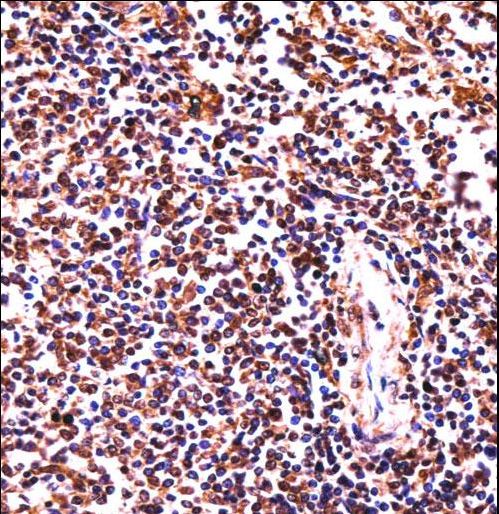 HCLS1 Antibody immunohistochemistry of formalin-fixed and paraffin-embedded human spleen tissue followed by peroxidase-conjugated secondary antibody and DAB staining.