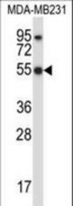 HCLS1 Antibody western blot of MDA-MB231 cell line lysates (35 ug/lane). The HCLS1 antibody detected the HCLS1 protein (arrow).