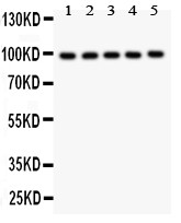 HCN1 antibody Western blot. All lanes: Anti HCN1 at 0.5 ug/ml. Lane 1: Rat Brain Tissue Lysate at 50 ug. Lane 2: Mouse Brain Tissue Lysate at 50 ug. Lane 3: HELA Whole Cell Lysate at 40 ug. Lane 4: U87 Whole Cell Lysate at 40 ug. Lane 5: MCF-7 Whole Cell Lysate at 40 ug. Predicted band size: 99 kD. Observed band size: 99 kD.
