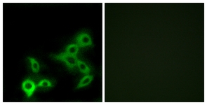 Immunofluorescence of LOVO cells, using GPBAR Antibody. The picture on the right is treated with the synthesized peptide.