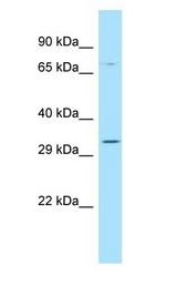 GPBAR1 / TGR5 antibody Western Blot of MCF7.