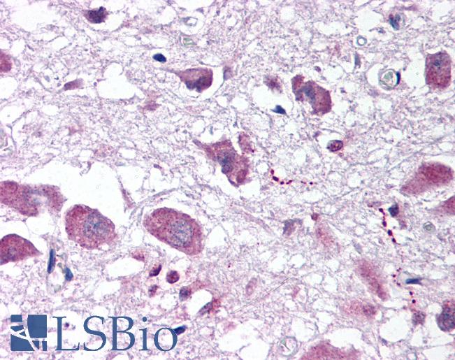 Anti-HCRT / Orexin antibody IHC of human brain, hypothalamus. Immunohistochemistry of formalin-fixed, paraffin-embedded tissue after heat-induced antigen retrieval. Antibody LS-B31 concentration 10 ug/ml.