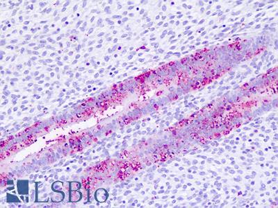 Human Uterus, Endometrium: Formalin-Fixed, Paraffin-Embedded (FFPE)