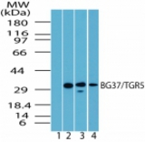 Western blot of BG37/TGR5 in spleen lysate. Lane 1 shows pre-immune sera. Lanes 2, 3 and 4 show antibody tested on human (1:1000), mouse (1:5000) and rat (1:5000) spleen lysate, respectively.