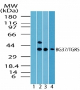 Western blot of BG37/TGR5 in spleen lysate. Lane1 shows pre-immune sera. Lanes 2, 3 and 4 show antibody tested on human (1:1000), mouse (1:5000) and rat (1:5000) spleen lysate, respectively.