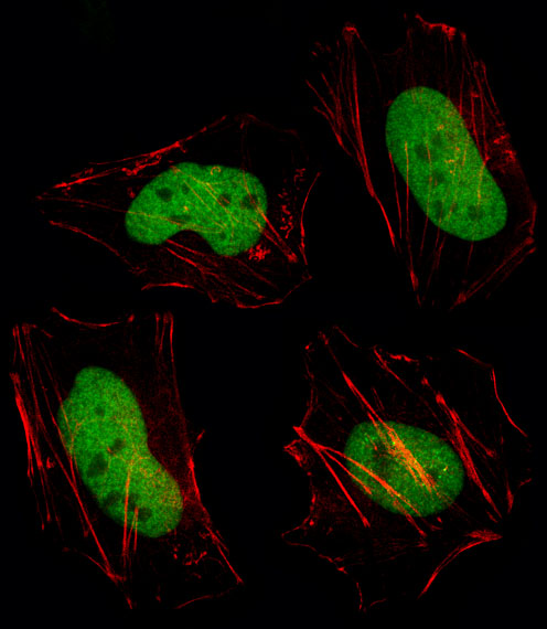Fluorescent image of HeLa cell stained with HDAC1 Antibody. HeLa cells were fixed with 4% PFA (20 min), permeabilized with Triton X-100 (0.1%, 10 min), then incubated with HDAC1 primary antibody (1:25, 1 h at 37°C). For secondary antibody, Alexa Fluor 488 conjugated donkey anti-rabbit antibody (green) was used (1:400, 50 min at 37°C). Cytoplasmic actin was counterstained with Alexa Fluor 555 (red) conjugated Phalloidin (7units/ml, 1 h at 37°C). HDAC1 immunoreactivity is localized to Nucleus significantly.