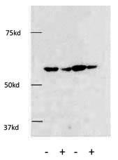 The anti-HDAC1 antibody was used in Western Blot to detect HDAC1 in HEK293 cells. Knockdown of HDAC1 using siRNA against HDAC1 showed a significant decrease of HDAC1 protein using this anti-HDAC1 antibody in HEK293 cells.
