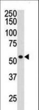 The anti-HDAC1 antibody is used in Western blot to detect HDAC1 in ZR-75-1 cell lysate.