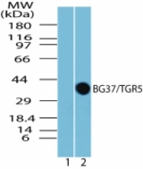 Western blot of BG37/TGR5 in spleen lysate. Lane 1 shows pre-immune sera. Lane 2 shows antibody tested at 1:5000 on mouse spleen lysate.