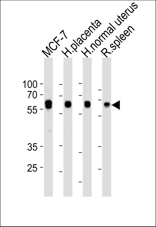 HDAC1 Antibody western blot of MCF-7 cell line and human placenta and normal uterus,rat spleen lysates (35 ug/lane). The HDAC1 antibody detected the HDAC1 protein (arrow).