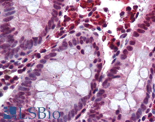 Anti-TGR5 antibody IHC of human colon. Immunohistochemistry of formalin-fixed, paraffin-embedded tissue after heat-induced antigen retrieval. Antibody LS-B1798 concentration 10 ug/ml.