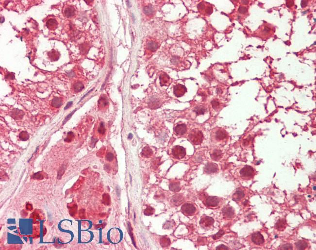 Anti-HDAC10 antibody IHC staining of human testis. Immunohistochemistry of formalin-fixed, paraffin-embedded tissue after heat-induced antigen retrieval. Antibody LS-B10812 concentration 5 ug/ml.