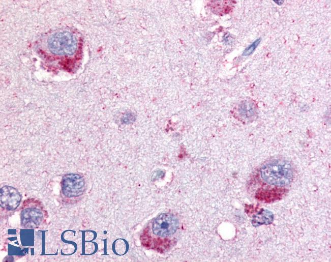 Anti-PYGB antibody LS-A2282 IHC of human brain. Immunohistochemistry of formalin-fixed, paraffin-embedded tissue after heat-induced antigen retrieval.