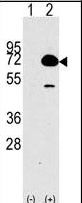 Western blot of HDAC10 (arrow) using rabbit polyclonal HDAC10 Antibody (RB02583). 293 cell lysates (2 ug/lane) either nontransfected (Lane 1) or transiently transfected with the HDAC10 gene (Lane 2) (Origene Technologies).