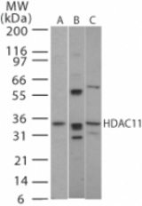 Western blot of HDAC11 in (A) human, (B) mouse and (C) rat brain tissue using antibody at 2 ug/ml.